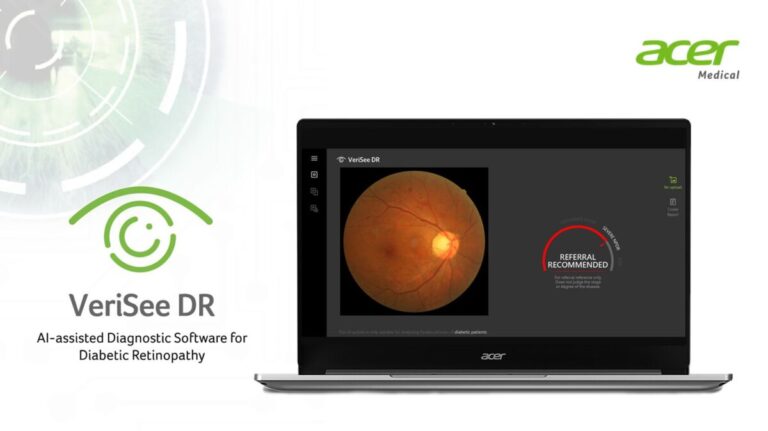 Acer offers diabetic retinopathy AI-assisted diagnostic solution to local hospitals and clinics